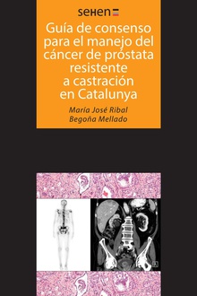 Guía de consenso para el manejo del cáncer de próstata resistente a castración en Catalunya